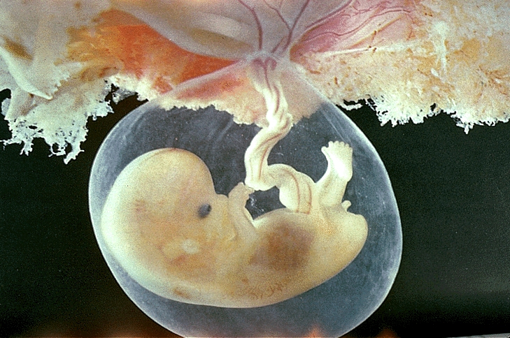 embrione2
